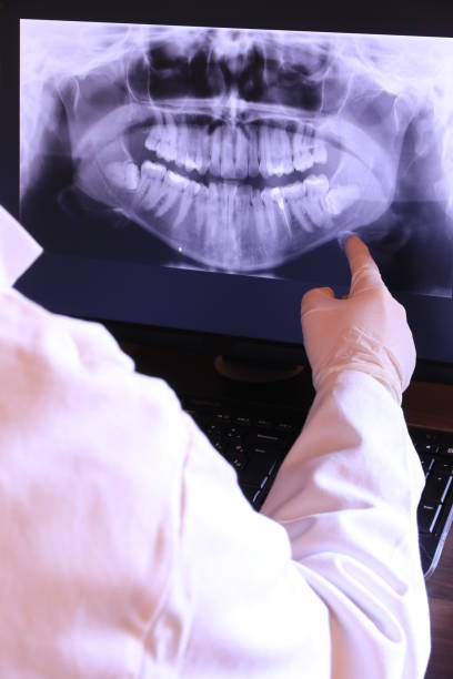 Best Emergency Dental Care for Broken or Chipped Teeth in Lake Meade, PA